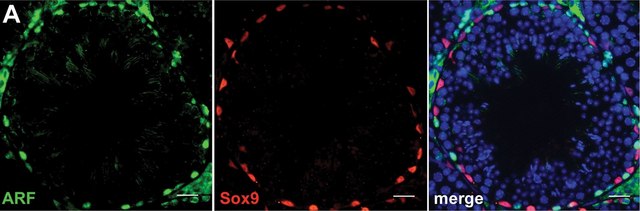 Anti-Sox9 Antibody Chemicon&#174;, from rabbit