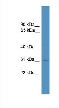 Anti-MBD3 antibody produced in rabbit affinity isolated antibody