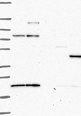 Anti-PRKAR2B antibody produced in rabbit Prestige Antibodies® Powered by Atlas Antibodies, affinity isolated antibody, buffered aqueous glycerol solution
