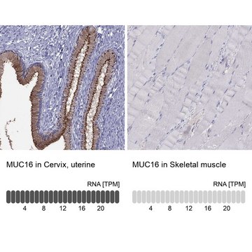 Anti-MUC16 Prestige Antibodies&#174; Powered by Atlas Antibodies, affinity isolated antibody