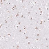 Anti-TUBGCP2 antibody produced in rabbit Prestige Antibodies® Powered by Atlas Antibodies, affinity isolated antibody, buffered aqueous glycerol solution