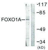 Anti-FOXO1A antibody produced in rabbit affinity isolated antibody