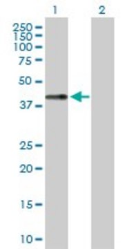 Anti-LECT1 antibody produced in rabbit purified immunoglobulin, buffered aqueous solution