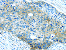 Anti-WASF2 affinity isolated antibody