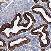 Anti-RCN1 antibody produced in rabbit Prestige Antibodies® Powered by Atlas Antibodies, affinity isolated antibody, buffered aqueous glycerol solution
