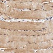 Anti-FKBP3 antibody produced in rabbit Prestige Antibodies® Powered by Atlas Antibodies, affinity isolated antibody, buffered aqueous glycerol solution