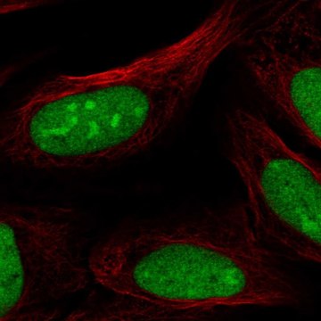 Anti-CRISPLD2 antibody produced in rabbit Prestige Antibodies&#174; Powered by Atlas Antibodies, affinity isolated antibody