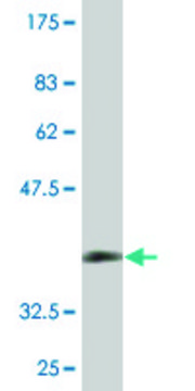 Monoclonal Anti-ZDHHC13 antibody produced in mouse clone 2A4, purified immunoglobulin, buffered aqueous solution