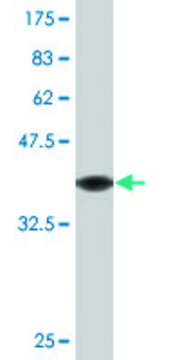 Monoclonal Anti-SORD, (N-terminal) antibody produced in mouse clone 2B8, purified immunoglobulin, buffered aqueous solution