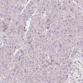 Anti-SIPA1 antibody produced in rabbit Prestige Antibodies® Powered by Atlas Antibodies, affinity isolated antibody, buffered aqueous glycerol solution