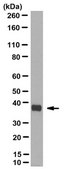 Anti-Aldolase C Antibody, C-Term, clone 1A1 clone 1A1, from mouse