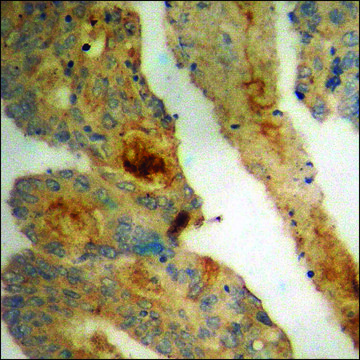 Anti-phospho-PDGFR &#946; (pTyr740) antibody produced in rabbit affinity isolated antibody