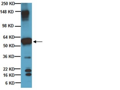 Anti-Beta III Tubulin Antibody Chemicon&#174;, from chicken