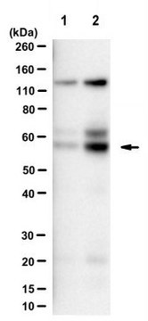 Anti-Rabex-5 Antibody, clone G32