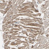 Anti-MAP3K10 antibody produced in rabbit Prestige Antibodies® Powered by Atlas Antibodies, affinity isolated antibody, buffered aqueous glycerol solution