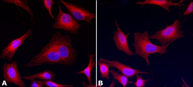 抗 &#945;-微管蛋白抗体，小鼠单克隆 clone AA13, purified from hybridoma cell culture