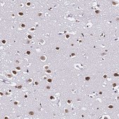 Anti-POLR1A antibody produced in rabbit Prestige Antibodies® Powered by Atlas Antibodies, affinity isolated antibody, buffered aqueous glycerol solution