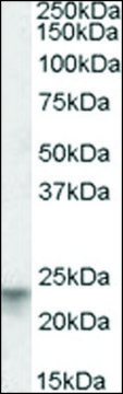 Anti-TSPAN8 antibody produced in goat affinity isolated antibody, buffered aqueous solution