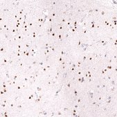 Monoclonal Anti-Bcl11A Antibody Produced In Mouse Prestige Antibodies® Powered by Atlas Antibodies, clone CL13501, affinity isolated antibody, buffered aqueous glycerol solution