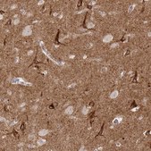 Anti-SLC9A6 antibody produced in rabbit Prestige Antibodies® Powered by Atlas Antibodies, affinity isolated antibody, buffered aqueous glycerol solution