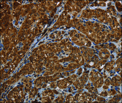 抗-HSD17B13 兔抗 affinity isolated antibody