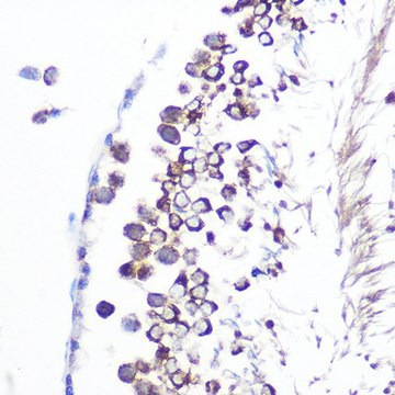 Anti-JAB1/CSN5/COPS5 antibody produced in rabbit