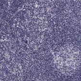 Anti-ANO1 Prestige Antibodies® Powered by Atlas Antibodies, affinity isolated antibody