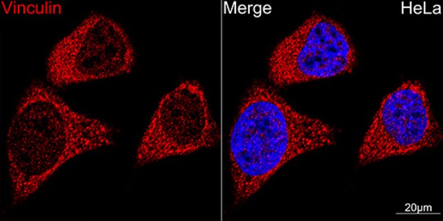 Anti-Vinculin Antibody, clone 9I3Y8, Rabbit Monoclonal