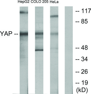 Anti-YAP antibody produced in rabbit affinity isolated antibody