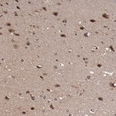 Anti-RGS6 antibody produced in rabbit Prestige Antibodies® Powered by Atlas Antibodies, affinity isolated antibody, buffered aqueous glycerol solution