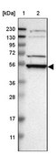 Anti-RRP1 antibody produced in rabbit Prestige Antibodies® Powered by Atlas Antibodies, affinity isolated antibody, buffered aqueous glycerol solution, Ab1