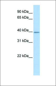 Anti-TXNIP antibody produced in rabbit affinity isolated antibody