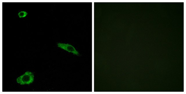 Anti-ACTHR antibody produced in rabbit affinity isolated antibody