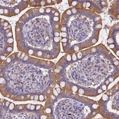Anti-RC3H2 antibody produced in rabbit Prestige Antibodies® Powered by Atlas Antibodies, affinity isolated antibody, buffered aqueous glycerol solution