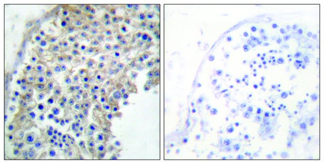 抗-肾上腺素受体 &#945;-2A 兔抗 affinity isolated antibody