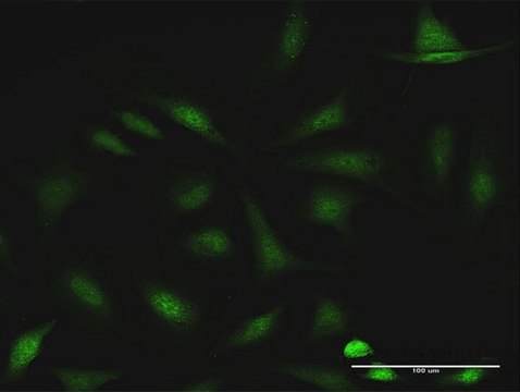 Anti-CCDC6 antibody produced in rabbit purified immunoglobulin, buffered aqueous solution