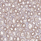 Anti-PREP antibody produced in rabbit Prestige Antibodies® Powered by Atlas Antibodies, affinity isolated antibody, buffered aqueous glycerol solution