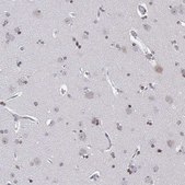 Anti-XPC antibody produced in rabbit Prestige Antibodies® Powered by Atlas Antibodies, affinity isolated antibody, buffered aqueous glycerol solution
