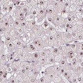 Anti-GNL3 antibody produced in rabbit Prestige Antibodies® Powered by Atlas Antibodies, affinity isolated antibody, buffered aqueous glycerol solution