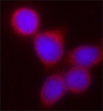 Anti-Kindlin-1 antibody, Mouse monoclonal clone KN-4, purified from hybridoma cell culture