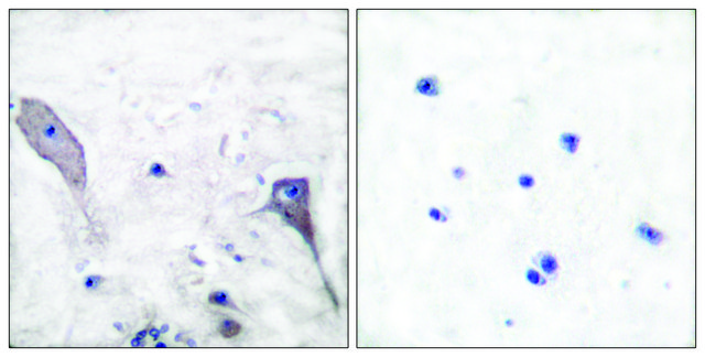 Anti-PATCHED, N-Terminal antibody produced in rabbit affinity isolated antibody