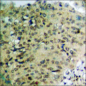 Anti-phospho-IKK-β (pTyr188) antibody produced in rabbit affinity isolated antibody