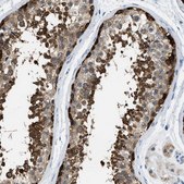 Anti-TOMM34 antibody produced in rabbit Prestige Antibodies® Powered by Atlas Antibodies, affinity isolated antibody, buffered aqueous glycerol solution