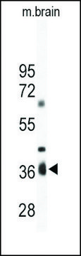 Anti-ART4 (C-term) antibody produced in rabbit IgG fraction of antiserum, buffered aqueous solution