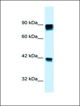 Anti-RB1 antibody produced in rabbit affinity isolated antibody