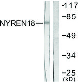Anti-NYREN18 antibody produced in rabbit affinity isolated antibody