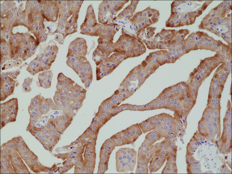 Anti-PSA (Prostate Specific Antigen) antibody, Rabbit monoclonal recombinant, expressed in HEK 293 cells, clone RM323, purified immunoglobulin