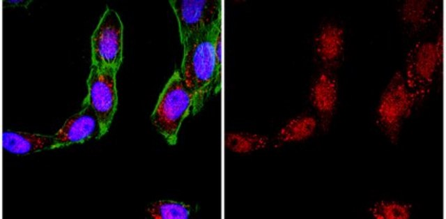 Anti-Bak (NT) Antibody from rabbit, purified by affinity chromatography