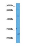 Anti-CHMP4B antibody produced in rabbit affinity isolated antibody