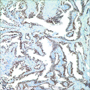 TTF-1 (8G7G3/1) Mouse Monoclonal Antibody